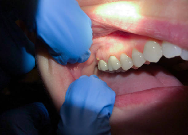Best Urgent Care for Lost Fillings or Crowns in Remerton, GA
