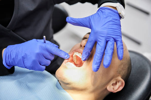 Best Emergency Gum Treatment in Remerton, GA